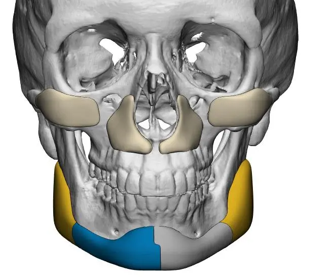 Harmonização Facial Definitiva estruturada na Vila Mariana, São Paulo